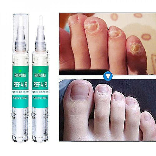 3ml Nail Nutrition Pen Antifungal Nail Repair Solution Bright Nail Bio Protective Film Nail Care Pen