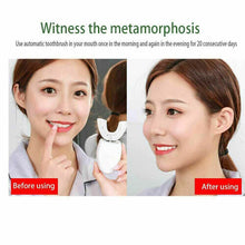 Automatic Sonic Electric Toothbrush U-Shaped Wireless Whitening Brush