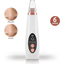 Blackhead Remover Vacuum Pore Cleaner Facial Acne Spot Deep Suction