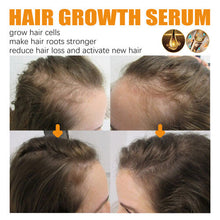 Hair Growth Serum, Beauty Hair Growth Serum, Revitalize Hair Growth Serum for Thinning Hair