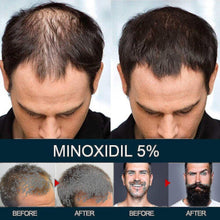 (Hair Regrowth 5% Extra Strength Topical Hair Loss For Men Solution.) Hair Regrowth 5% Extra Strength Topical Hair Loss For Men Solution.