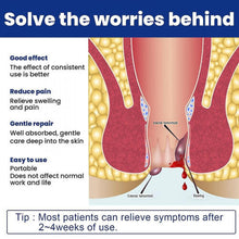 Hemorrhoid Cream Hemorrhoid Cream Elit Meat Ball Hemorrhoid Itng Compress L Rep Cream