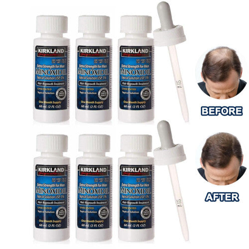 Kirkland Signature Minoxidil Topical Solution 6 Months Supply