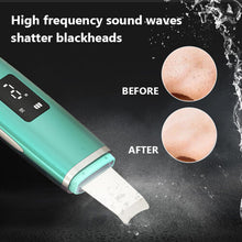 (Set C) 5PC Set Blackhead Remover Ultrasonic Skin Scrubber