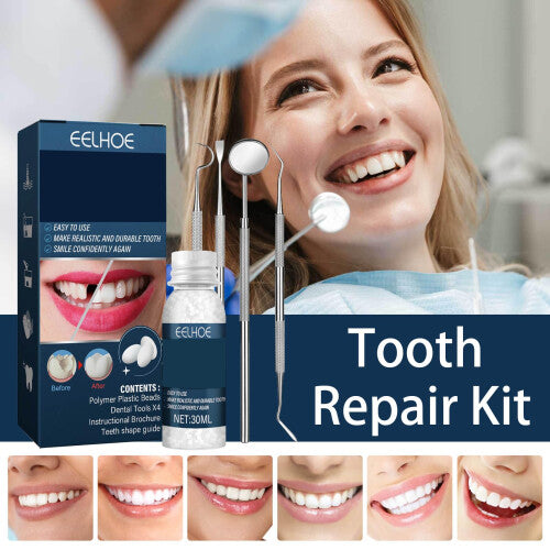 Tooth Repair Kit - Temporary Fake Teeth Replacement Kit with Dental Mirror Tools for Temporary Restoration of Missing & Broken Teeth Replacement